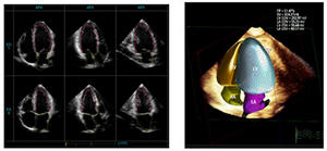 HeartModelA.I.（ハートモデル）