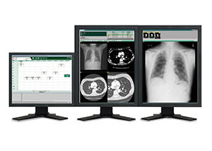 検査情報管理システム「SYNAPSE Wｚ（シナプス ウィズ）」