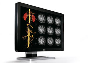 Coronis Fusion 4MP LED（MDCC-4330）