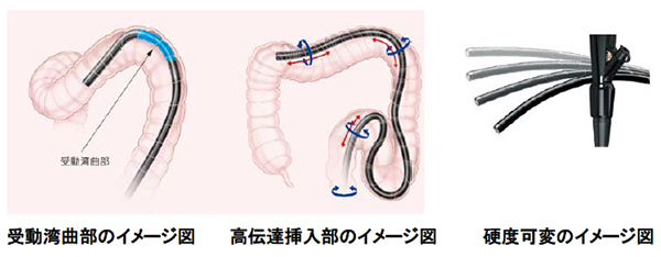 挿入性向上と苦痛の低減に貢献する3つの機能を搭載
