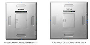 「FUJIFILM DR CALNEO Smart S47」「FUJIFILM DR CALNEO Smart S77」