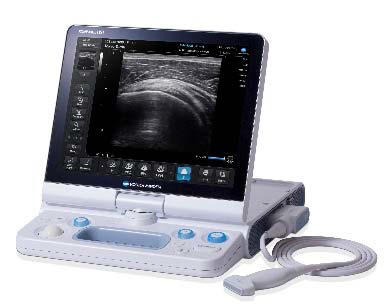 「SONIMAGE HS1」外観