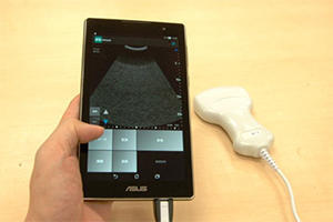 ポケットエコー miruco