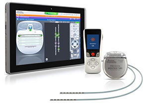 プレシジョン モンタージュ MRI SCS システム