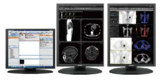 Centricity Universal Viewer 100 edition PET Centricity Radiology Report JPとの連携例