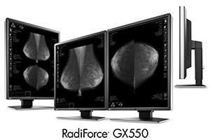 EIZO，5メガピクセル医用モニター「RadiForce GX550」発売 〜乳房