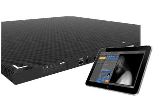 デジタル・ラジオグラフィ「Matrixia」