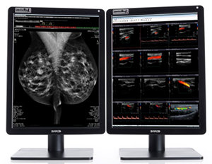 Nio Color 5.8MP（MDNC-6121） 外観