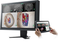 3次元画像解析システム「SYNAPSE VINCENT」