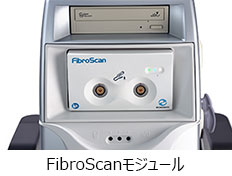 FibroScanモジュール
