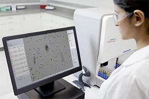 Atellica UAS800：鮮明なデジタル画像で判定結果を表示