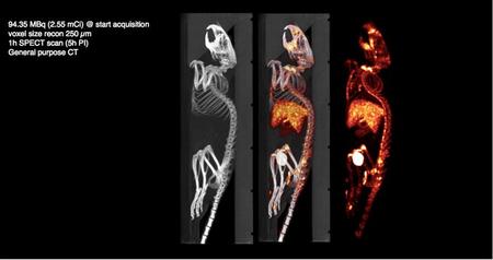 写真左から，X線CT画像，SPECT画像にX線CT画像を合わせた画像，SPECT画像