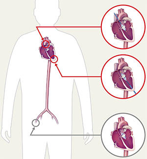 サピエン 3の3つのアプローチ