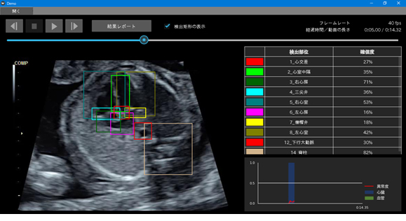 図2 今回開発した，胎児心臓超音波スクリーニング異常検知システム 超音波プローブを走査して得られる動画に対して，胎児の心臓と周辺臓器の各部位が実際に映っていたかを「確信度」として高速で算出し，操作画面上にリアルタイムで表示する。左画面の走査断面動画上には実際に検出された部位の位置・範囲を色つきの境界線で囲み，さらに，右上表には算出された各部位の確信度を提示する。また，右下グラフにはその確信度を用いて算出された心臓の構造と血管についての異常度の推移を示す。