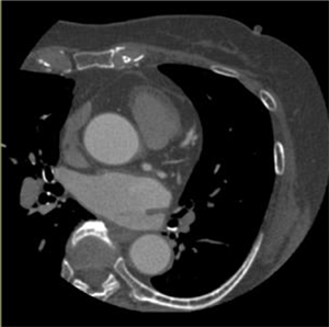 図1 心臓CT検査画像