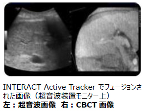 INTERACT Active Tracker