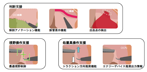 手術の進行状況に応じた情報支援例