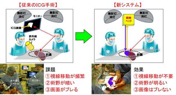 図2 これまでの手術法における課題と新システムによる効果