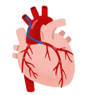 図1　ガイディングカテーテル