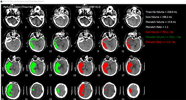 同製品を使った，CT画像の解析例