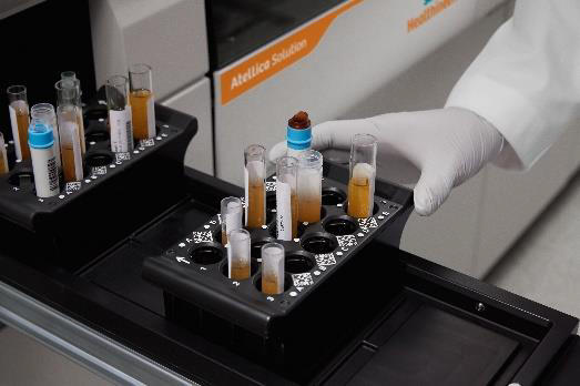 新型コロナウイルスの抗体検査キット