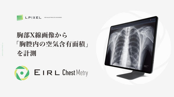 EIRL Chest Metry
