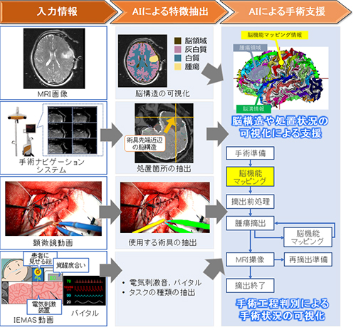 AIによる手術情報の解析イメージ