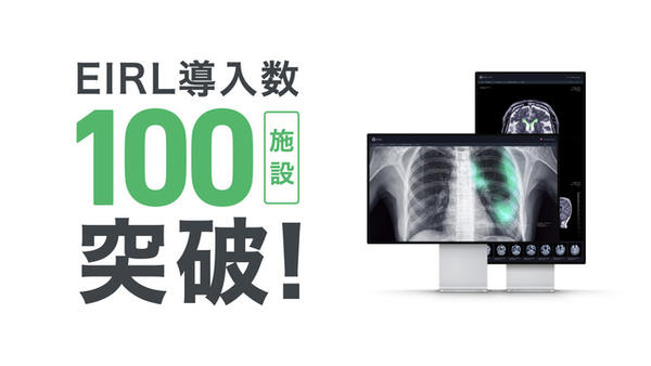 医療AIのエルピクセル，医用画像解析ソフトウェア EIRLの臨床導入，100施設を突破