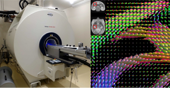 画像1：理化学研所のMRIスキャナーと拡散MRIデータ