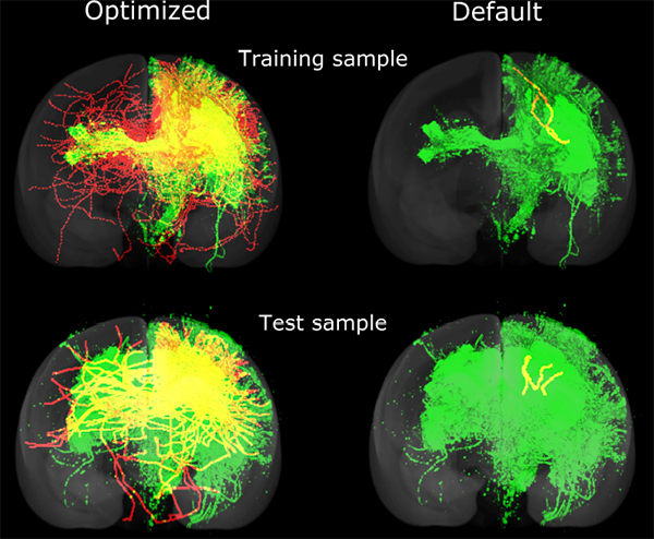 画像2：最適化されたパラメータと標準パラメータによる神経線維追跡結果の比較