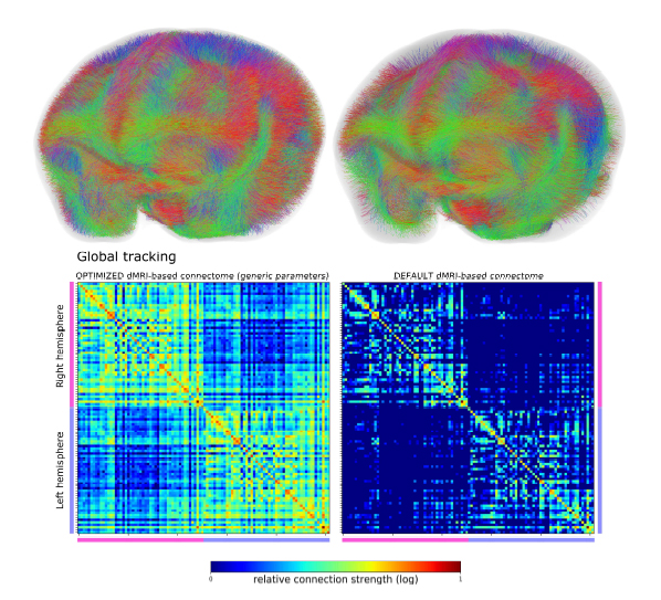 画像3：最適化したパラメータと標準パラメータでの全脳のコネクトームの違い。