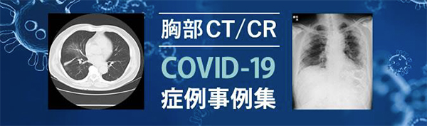 胸部CT/CR “COVID-19症例事例集”