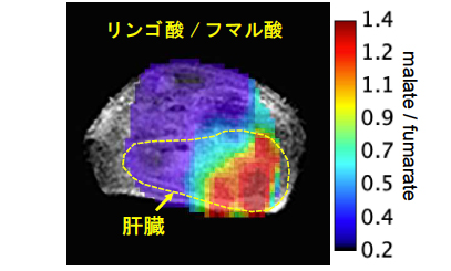 投与したフマル酸とリンゴ酸の 13C MRI信号強度の比から肝障害モデルマウスの壊死領域を可視化