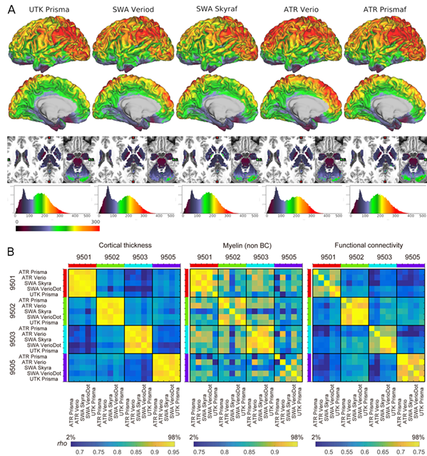 図2　国際脳調和プロトコルで得たMRI画像の前処理解析結果 A．単一被験者（ID＝9503）から得られた空間的信号雑音（S/N）比を大脳皮質表面にマッピングしたもの。5機種ともに同じように高いS/N比の信号が得られていることが示されている。B．4人の被験者が5機種で撮影を受けたMRIデータについて機種間と個人間の類似度について解析した結果。前処理されたトラベリングサブジェクトデータから抽出した，皮質厚（Cortical thickness），ミエリン化（Myelin），機能結合（Functional connectivity）の類似性を表す。9501，9502等は同一被験者を表している。個人間では類似度が低く青色を呈している。これはいわゆる個人間のバラつき（いわゆる個人差）が大きいことを示す。対して，個人内では類似度が高く，黄色を呈しており，個人内のバラつき（MRI装置や繰り返しによる違い）が小さく，どの装置でもこうした傾向は一貫していることがわかる。