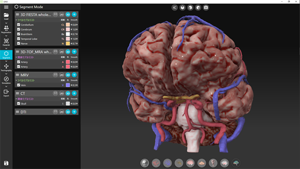 「GRID」の操作画面と，画面上に再現された脳の3次元可視化画像