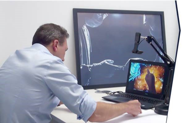 指導医の手を上からカメラで映し、手術映像に合成するイメージ図