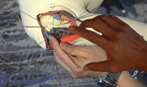手のAR映像（右）を共有している手術画面に重ねて表示するイメージ図