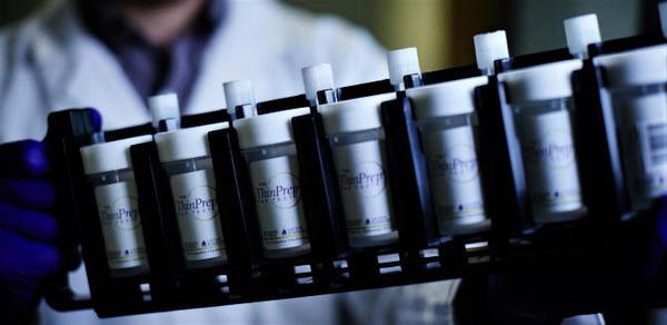 液状化検体細胞診ThinPrep