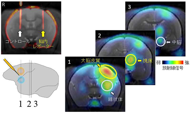 図3：霊長類脳で回路の構造を画像化 （左上）ウイルスベクターで脳内レポーターの遺伝子情報を片側大脳皮質（黄色円）と片側線条 体（水色円）の神経細胞へと導入している様子。 （左下）脳内レポーターの導入領域とPET画像提示している脳スライスの概略図 （右）PETで画像描出された投射経路の画像