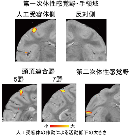図3：第一次体性感覚野の活動が下がると，「ものつかみネットワーク」への情報の流れも遮 断される