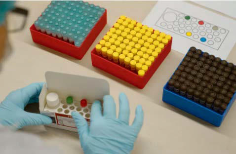 FTD SARS-CoV-2のイメージ