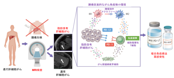 図1. MRI画像を用いた腫瘍内脂肪蓄積の定量化による，肝細胞がん複合免疫療法の治療効果予測