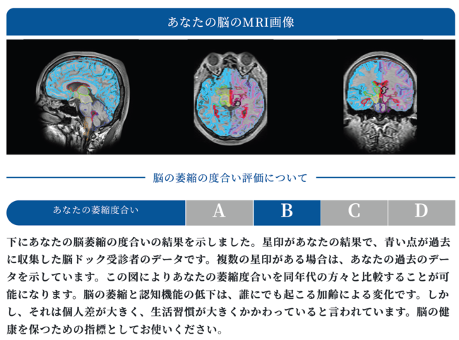 脳のMRI画像から画像解析により萎縮度合いを総合評価。これに加えて脳血管の健康度も総合評価する