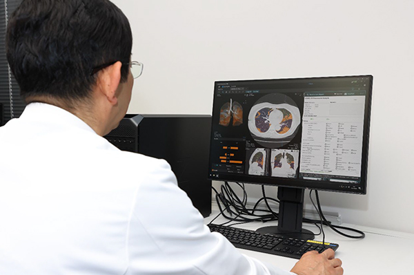 COVID-19肺炎解析ソフトウェア SCO-PA01」