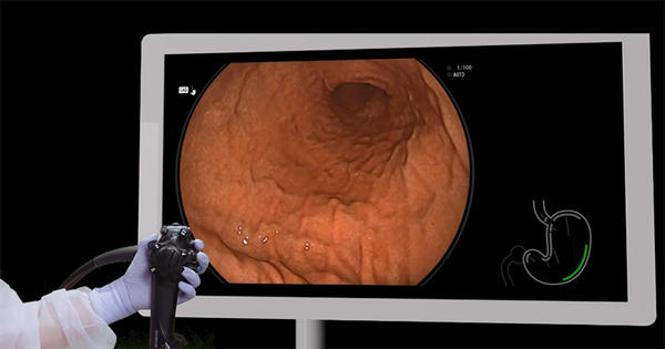 胃内のランドマークの静止画が撮影されると，モニターに出ている胃のイラストに撮影完了箇所が緑ラインで表示される。