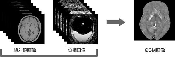 絶対値画像，位相画像→QSM画像