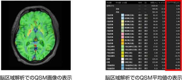 脳区域解析でのQSM画像の表示，脳区域解析でのQSM平均値の表示