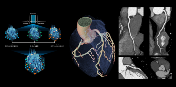 ※（左）SnapShot Freeze2.0の概念図 ターゲット心位相とその前後の心位相の合計3心位相のフェーズデータを用いて，心臓を構成する各ボクセルの動態を3次元的にベクトル解析し，変化量をフィードバックし静止画像を生成 ※（右）70kV, 0.23秒/回転で撮影した心臓CT画像