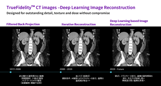 Deep learningを用いた画像再構成アルゴリズム
