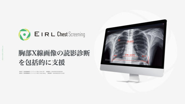 EIRL Chest Screening